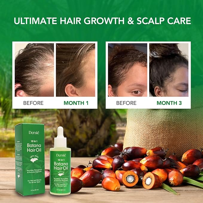 Hair Growth Oil with Batana and Rosemary: 10-in-1 Natural Hair Growth Treatment for Hair Loss, Damage & Thinning Hair - 10 Organic Vegan Oils for Men and Women of All Hair Types - 2 fl oz