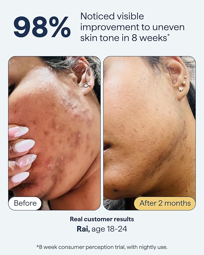 Remedy for Dark Spots | Advanced Night Treatment with Retinol & Kojic Acid | For Discoloration and Uneven Tones | With Glutathione, Niacinamide, Mandelic Acid | By Dermatologist Dr. Shah, 1 fl. oz