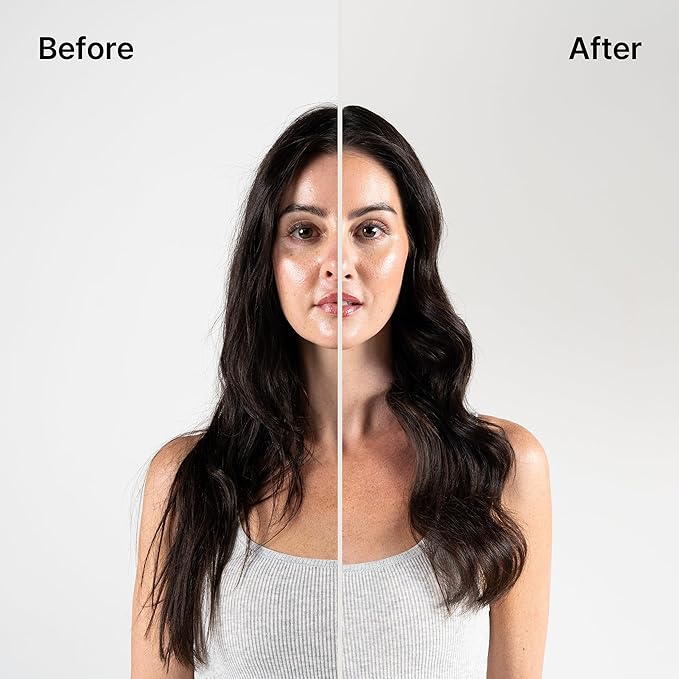 Thickening Treatment Conditioner with Matsutake Extract – The Ultimate Solution for Hair Thinning and Volume Loss, 100% Vegan, Parabens Free, for All Types of Hair, 10.1 oz