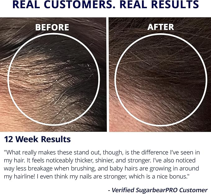 Sugarbear Hair Vitamin Gummy 2 Month Supply Extra Strength Biotin 6000mcg, Growth for Men & Women, Vegan Vitamin B12, MSM, Inositol, Omega 3, Elderberry, Certified Kosher, Halal, Cruelty-Free