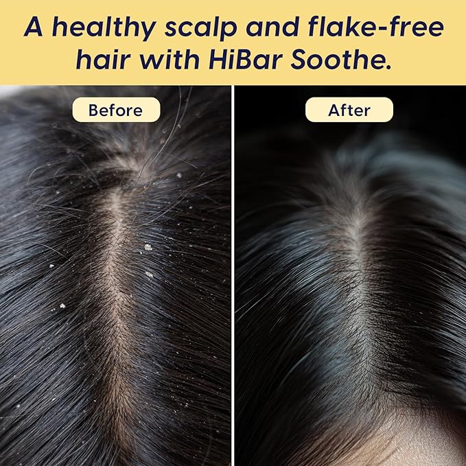 HiBAR - Soothe Conditioner Bar - For Dry, Itchy, Flaky Scalps - Improves Scalp Health - With Willow Bark Extract & Salicylic Acid - Plastic-Free - Soap, Paraben & Sulfate-Free -Color Safe -1 Solid Bar
