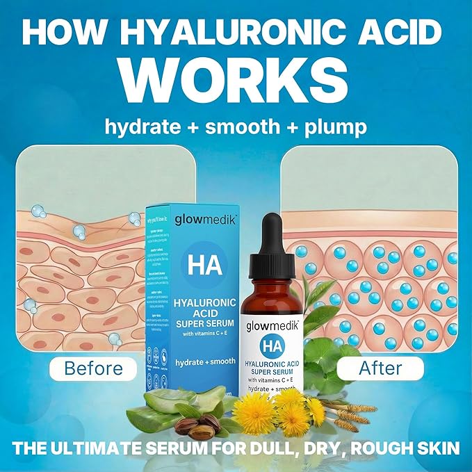 Glowmedik Hyaluronic Acid Serum for Face with Vitamin C & E - Hydrating Face Serum for Dry Skin, Fine Lines & Wrinkles - Vegan Facial Moisturizer for Women, 1 fl oz 30ml