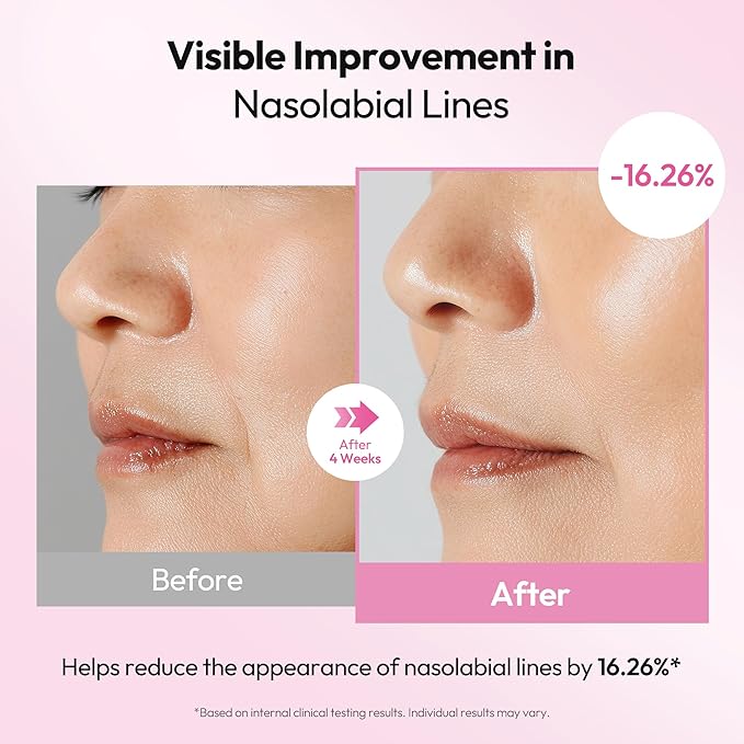 Recipe Milkfiline Boosting Ampoule - Age-Defying, Soothing & Hydrating Face Serum with 5% Volufiline, Niacinamide & Azelaic Acid for Dull, Dry Skin - Lightweight, Firming Korean Skin Care 1.01 fl oz