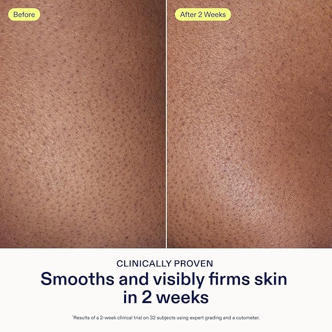 Skinfix AHA/BHA Renewing Body Cream - 10 oz - Skin-Softening Moisturizer with Gentle Exfoliation - Boosts Glow & Radiance - Vegan, Cruelty Free